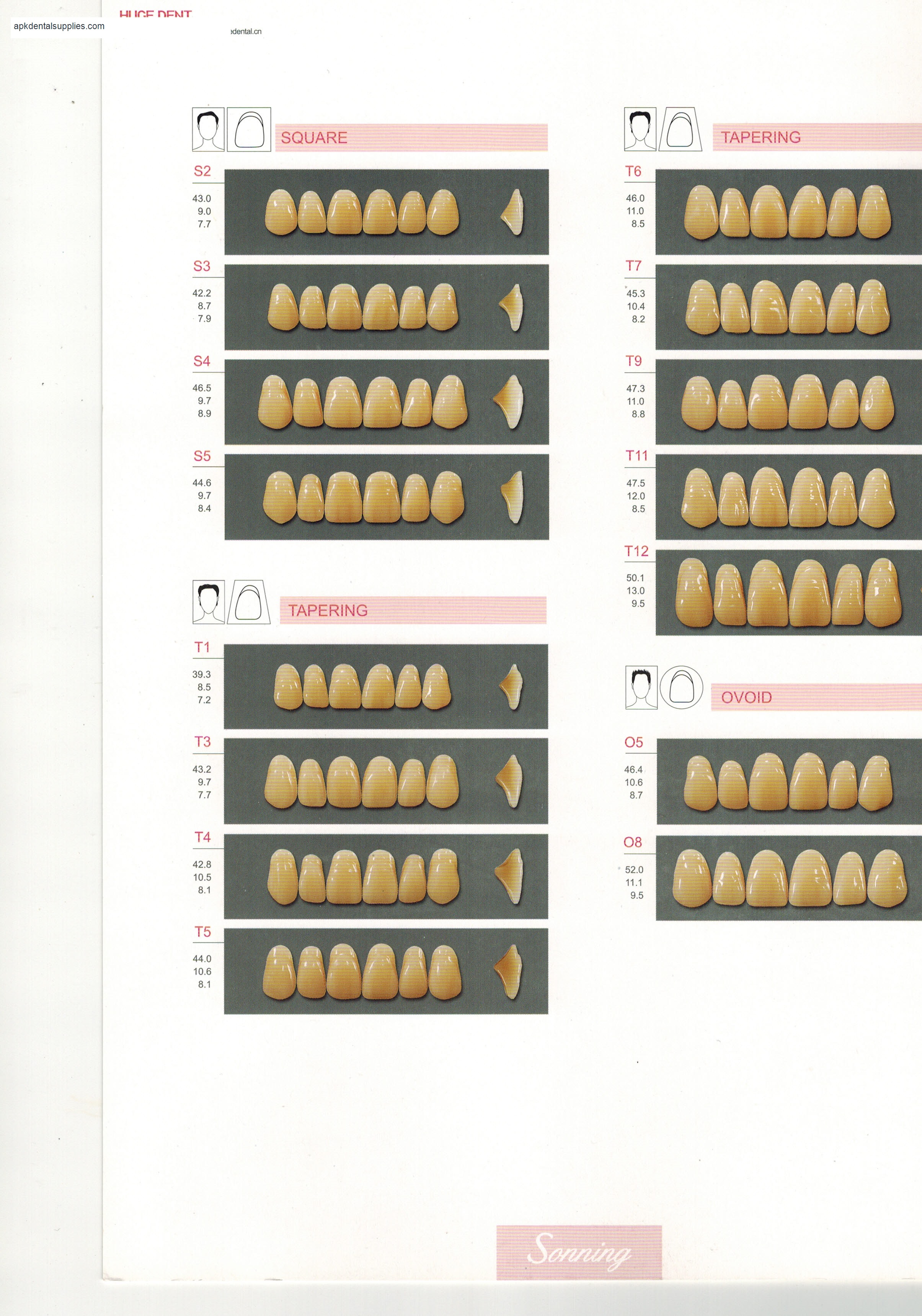 Sonning upper anterior moulds